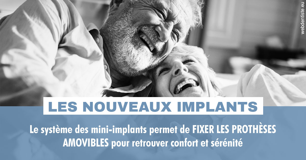 https://cabinetdentairelumiere.fr/Les nouveaux implants 2