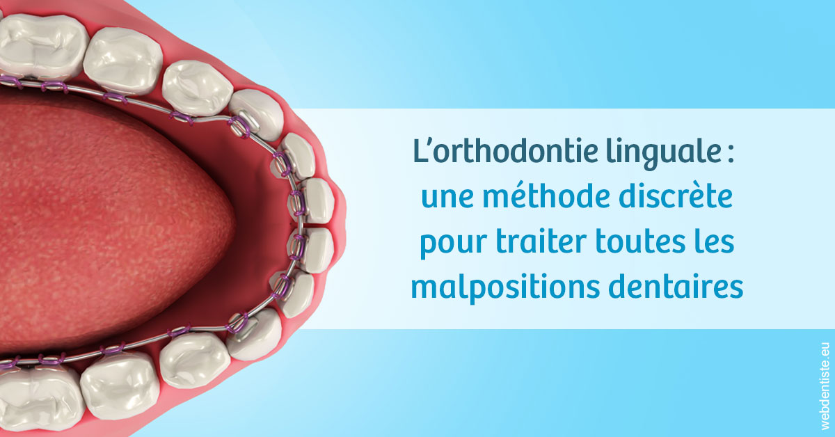 https://cabinetdentairelumiere.fr/L'orthodontie linguale 1