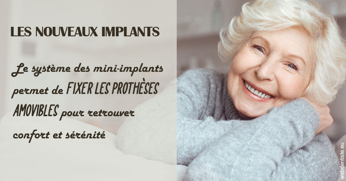 https://cabinetdentairelumiere.fr/Les nouveaux implants 1