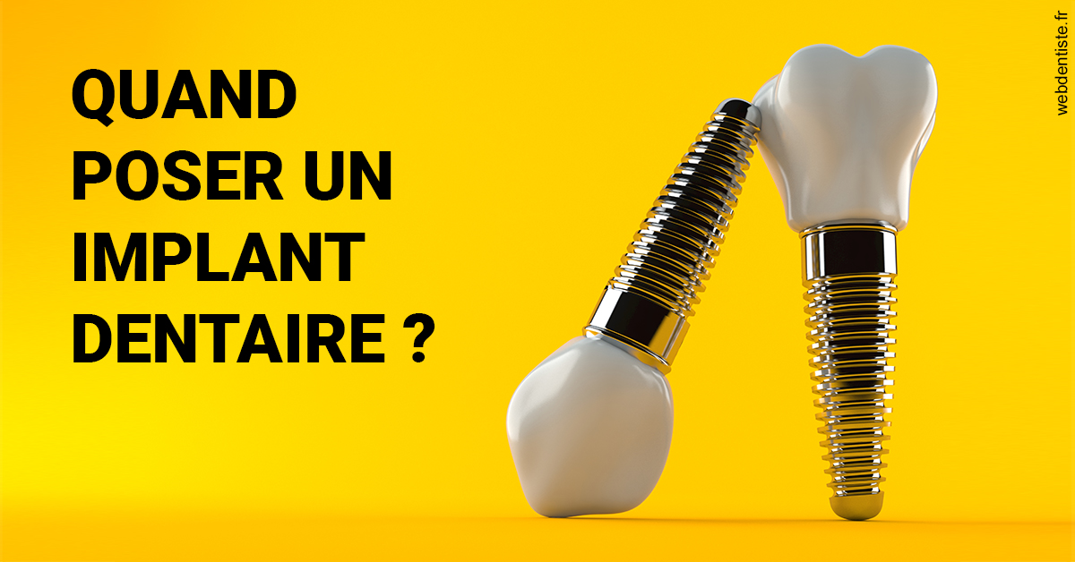 https://cabinetdentairelumiere.fr/Les implants 2