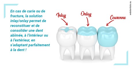 https://cabinetdentairelumiere.fr/L'INLAY ou l'ONLAY