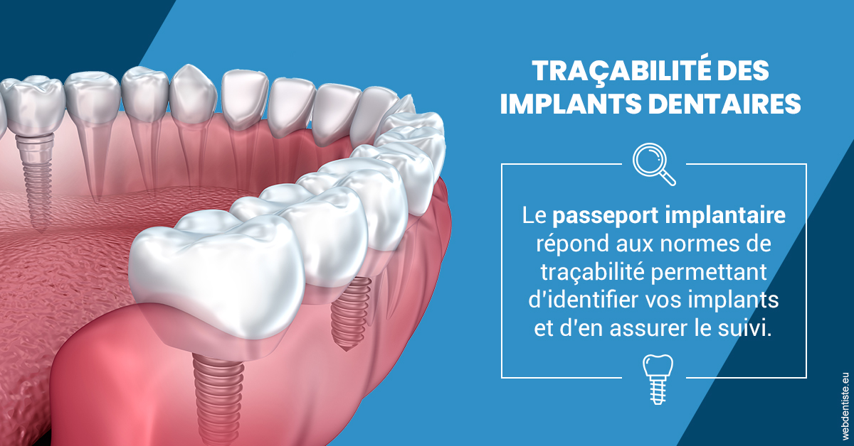 https://cabinetdentairelumiere.fr/T2 2023 - Traçabilité des implants 1