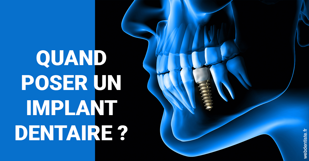 https://cabinetdentairelumiere.fr/Les implants 1