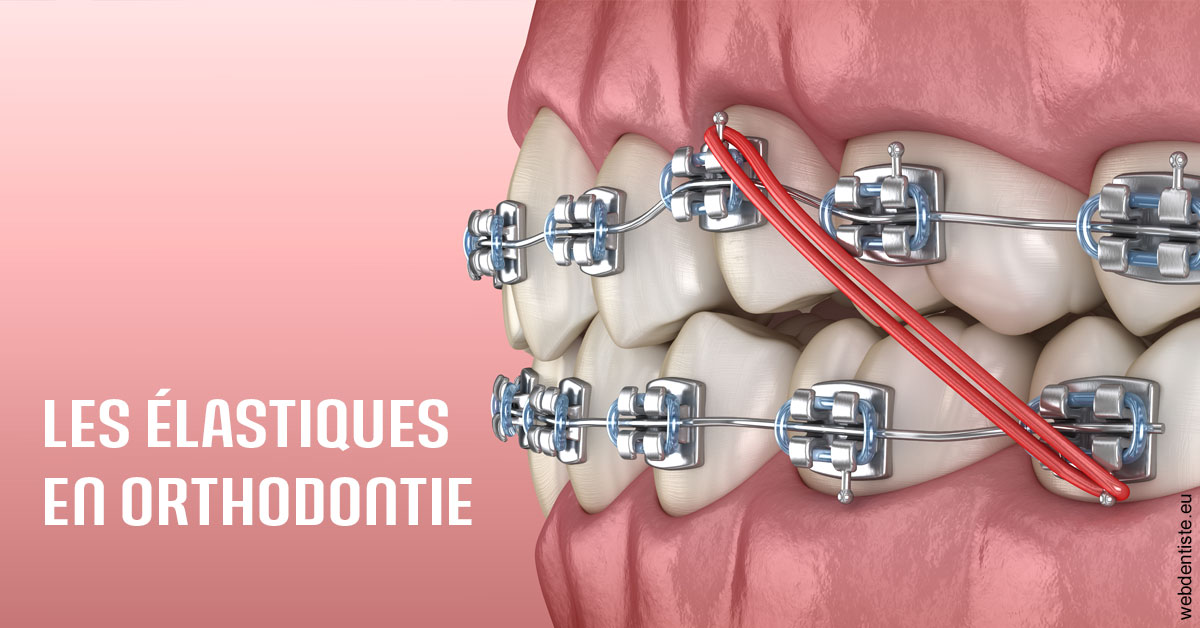 https://cabinetdentairelumiere.fr/Elastiques orthodontie 2