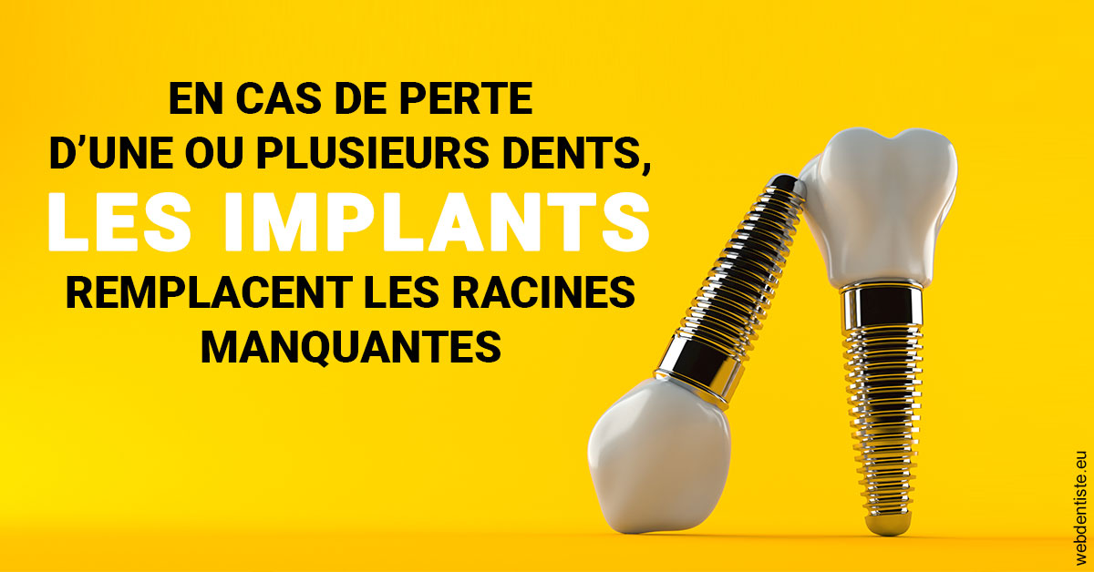 https://cabinetdentairelumiere.fr/Les implants 2