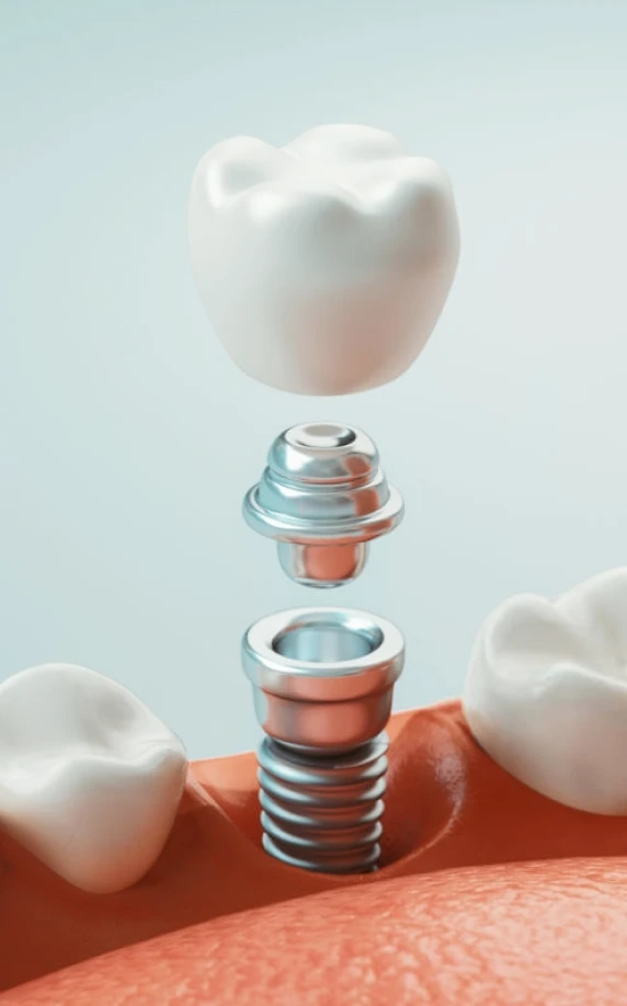artificial jaw dentist s officeAccueilChirurgiens-dentistes Lyon 3 | Cabinet Lumière
