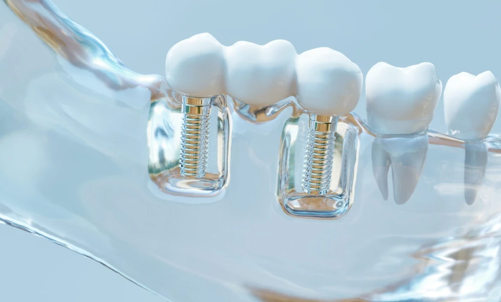 soins urgence lyonChirurgie réparatriceChirurgiens-dentistes Lyon 3 |   Cabinet Lumière