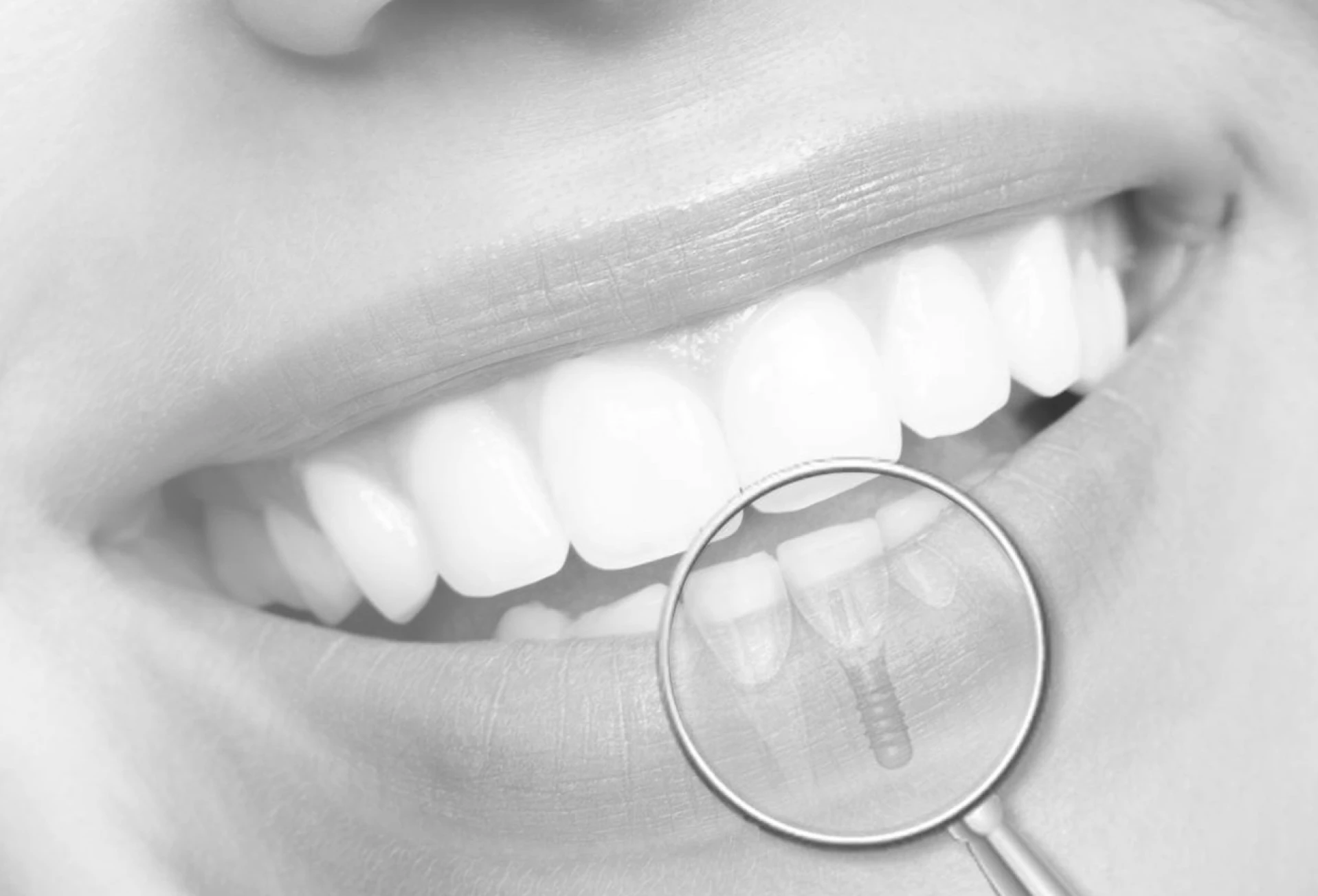 specialiste implant lyonAccueilChirurgiens-dentistes Lyon 3 |   Cabinet Lumière