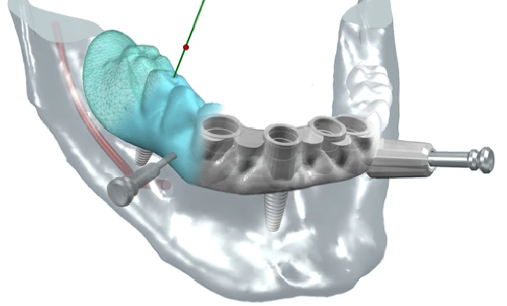 tarif implant dentaire lyonNos technologiesChirurgiens-dentistes Lyon 3 |   Cabinet Lumière