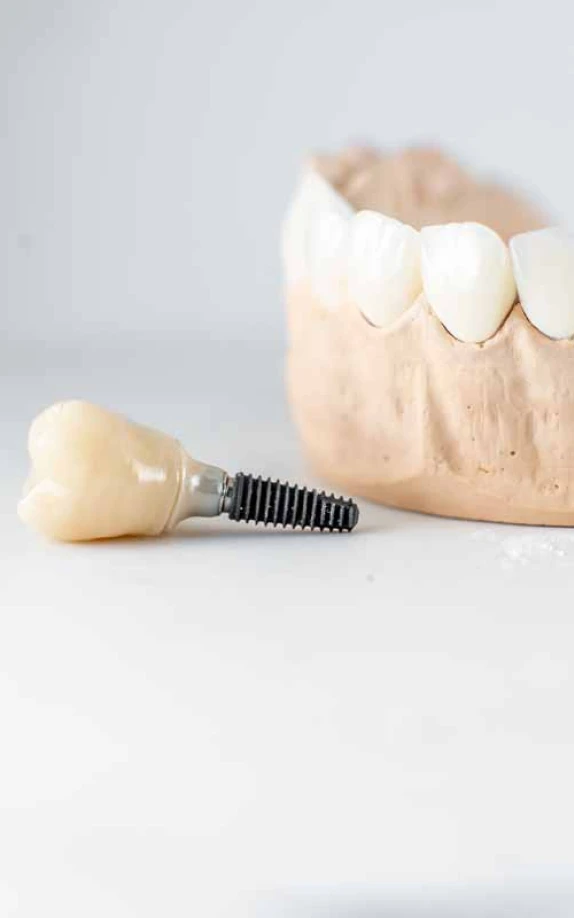 traitement parodontite lyonAccueilChirurgiens-dentistes Lyon 3 | Cabinet Lumière