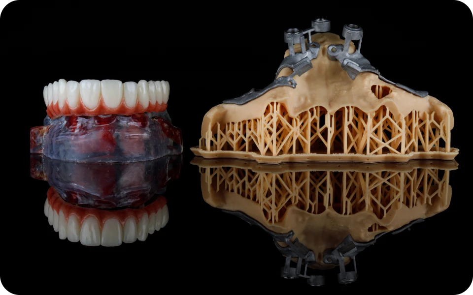 chirurgiens dentistes lyonImplants sous-périostésChirurgiens-dentistes Lyon 3 |   Cabinet Lumière